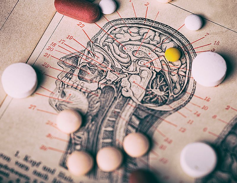 Migraine and severe migraine: what are your treatment options?