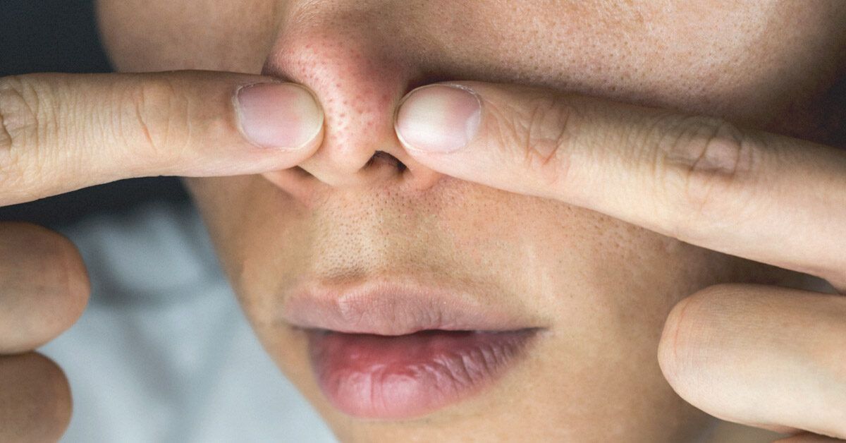 Red Spot On Nose Acne Cancer And Other Causes