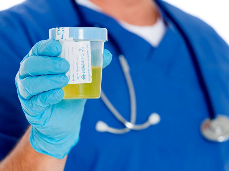 Prueba de glucosa en orina: Objetivo, procedimiento y resultados