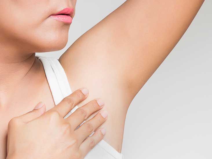 Dark Underarms: Treatment, Causes, and Prevention