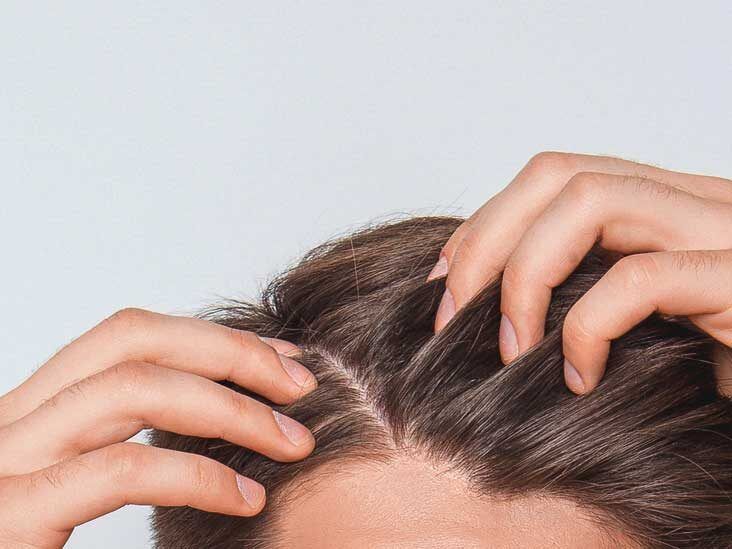 Scabs and Sores on Scalp: Potential Causes, Pictures, and Treatment
