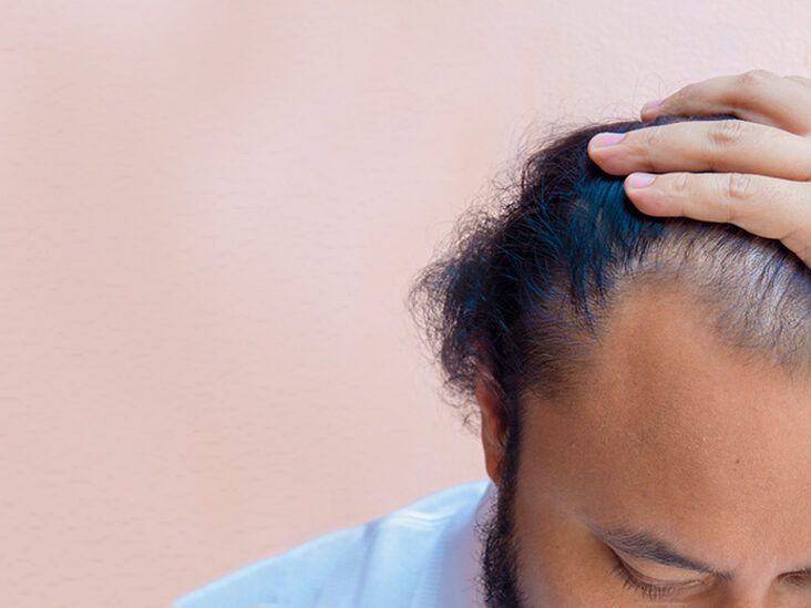 Hair Loss Reason,Hair Loss: सारे उपायों के बाद भी तेजी से गिर रहे हैं बाल,  तो कारण जान हो जाएं अलर्ट - hair care what are the main causes of constant  hair