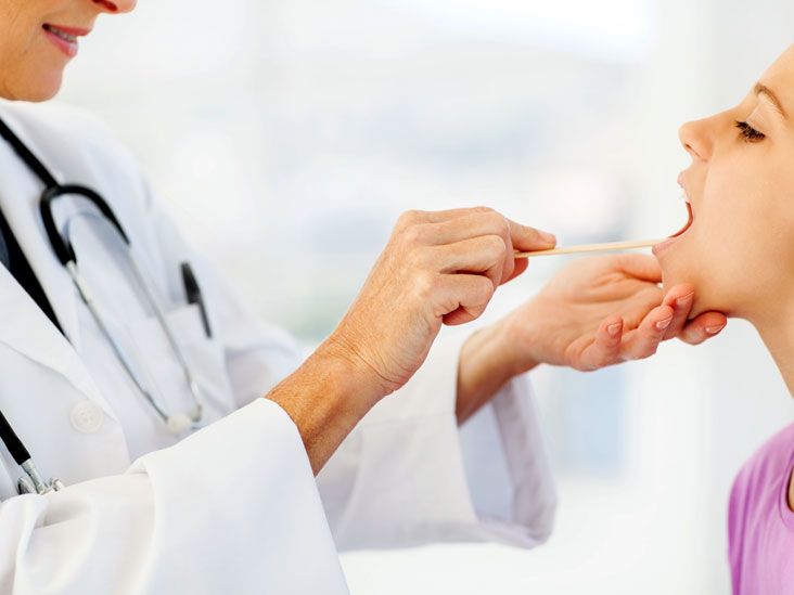 Tonsil Stones Symptoms, Treatments, Prevention, Removal