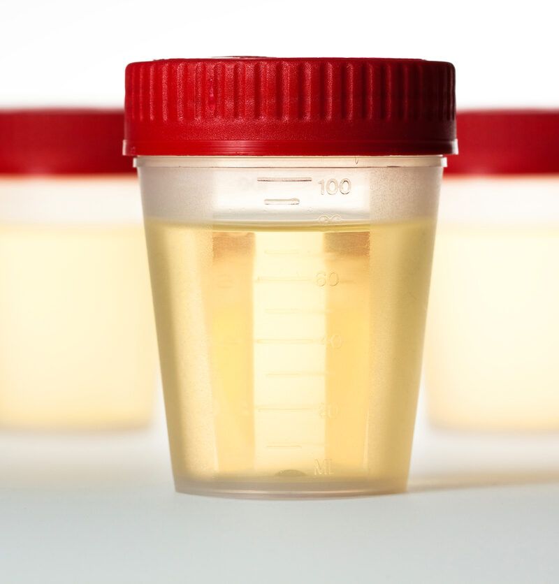 Characteristics of the first morning urine in the low and high drinkers