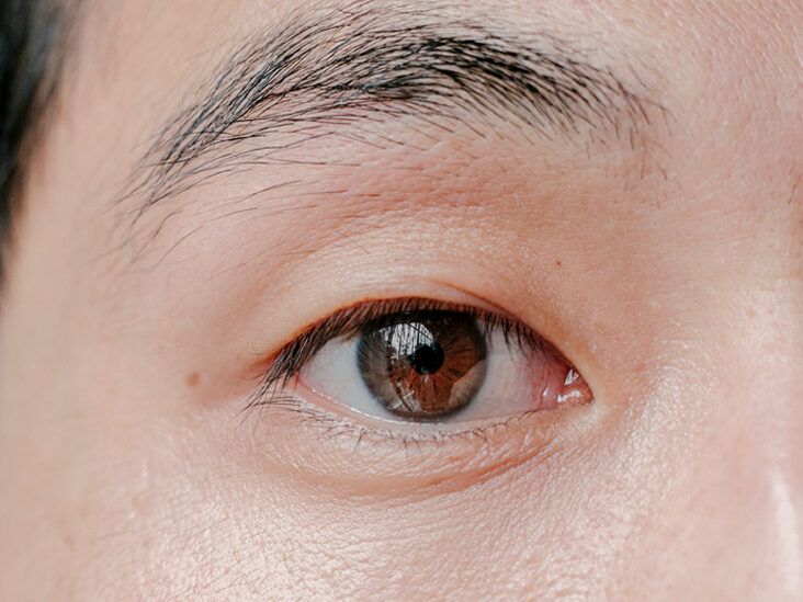 Green ring around my brown iris, do u guys have it too? : r/eyes