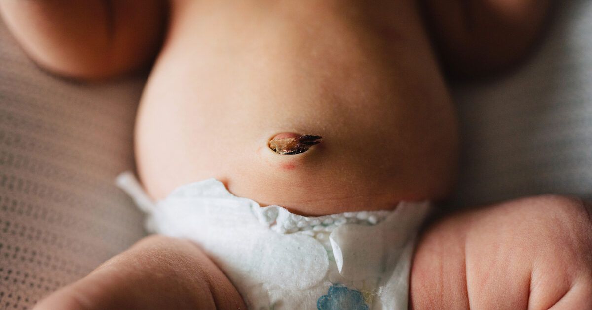 Umbilical and baby belly button care