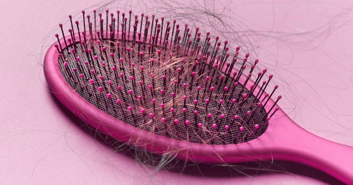 Hair Loss After Surgery Causes, Treatment, and Prevention