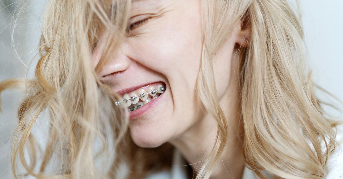 Learn about Lingual Braces Disadvantages - Orthodontic Arts