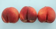 Hairy Butt Crack Causes If It Needs To Be Removed How To