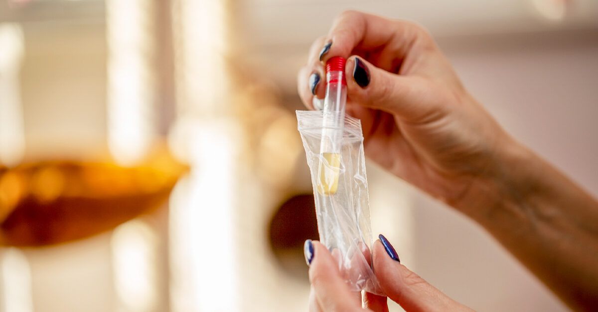 Urine Tests During Pregnancy: Why Urine Analysis Is So Important