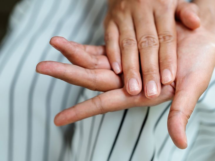Eggshell Nails Causes, Treatment, and When to See a Doctor