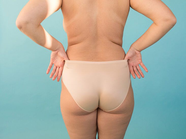 Can Wearing Thongs Cause Infections?