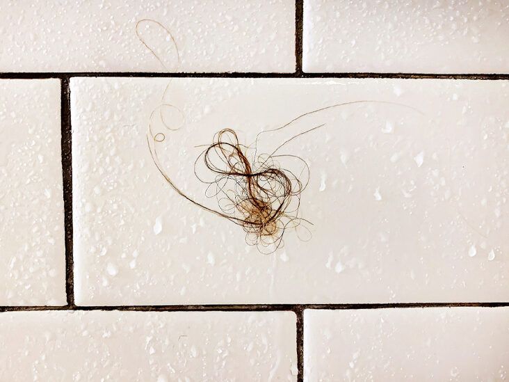 How To Stop Hair Loss In The Shower