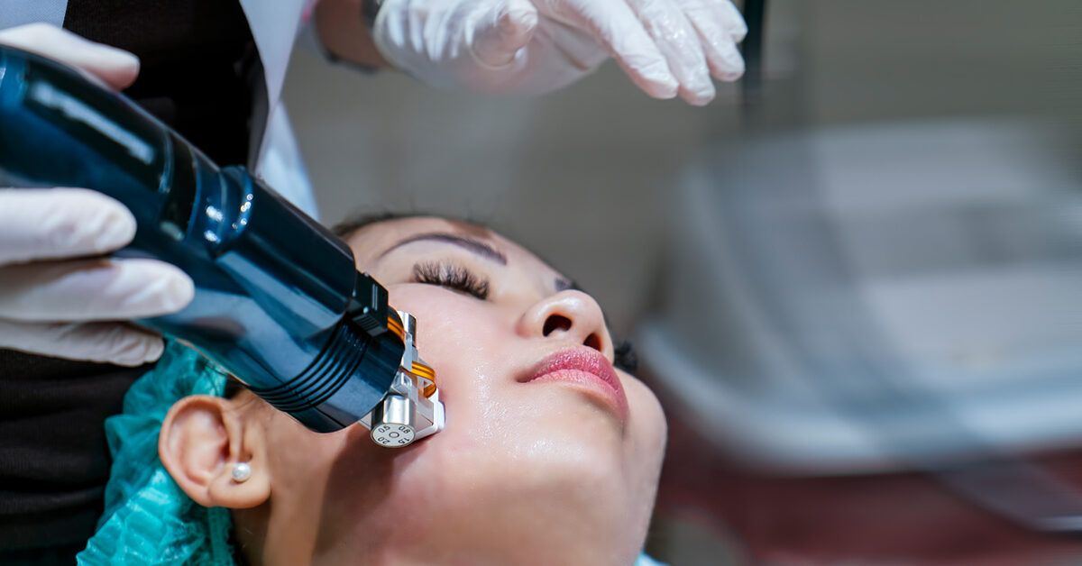 Radiofrequency Microneedling: Procedure, Aftercare, Side Effects, Cost