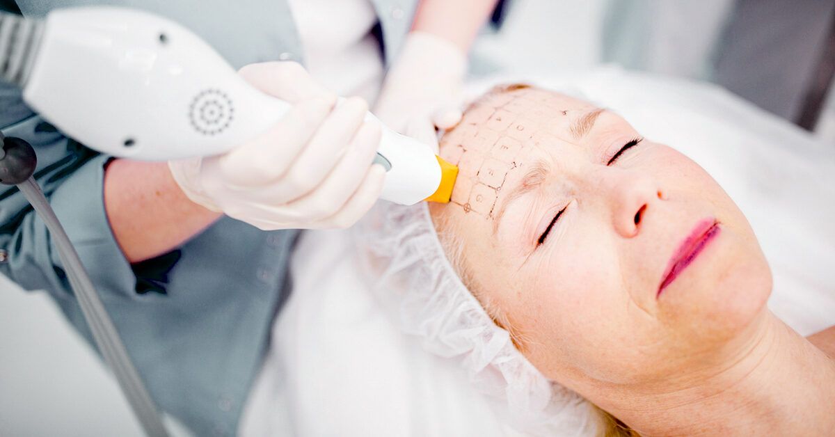 Thermage vs. Ultherapy: Candidates, Procedures & More