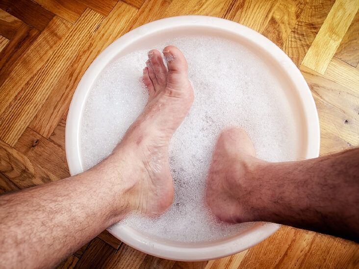 Home remedies to treat toenail fungus infections #applecidervinegar #v... |  TikTok