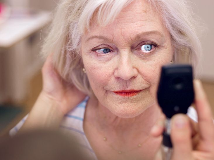 Graves’ Eye Disease Treatment and Resolution FAQs