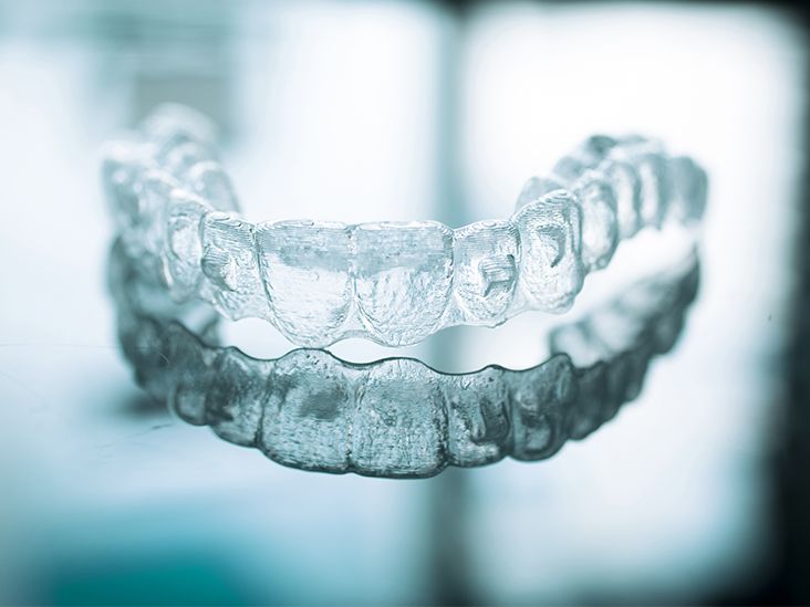 Why Do I Need Attachments Glued to My Teeth for Invisalign?