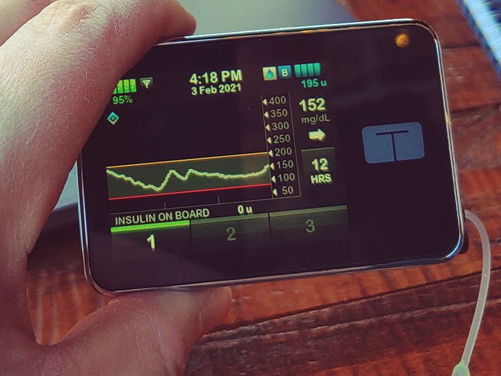 What to Do If Your Insulin Pump Malfunctions