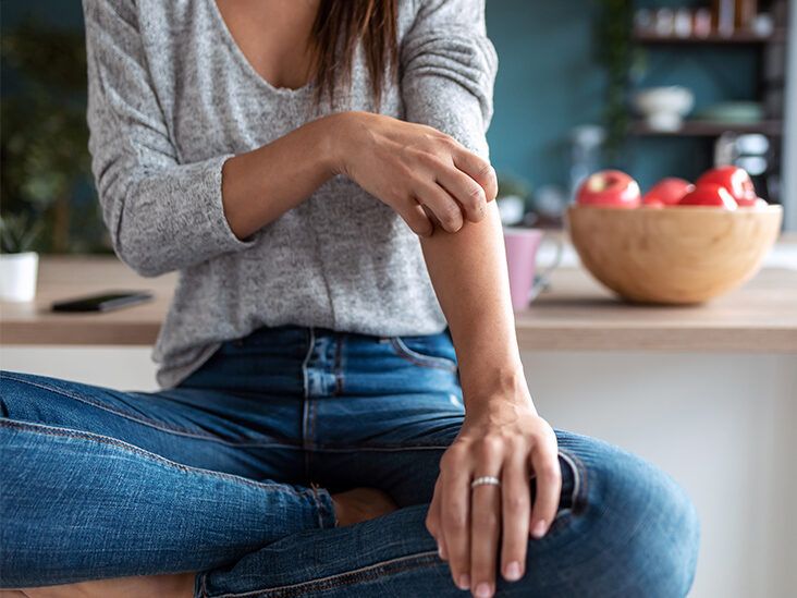 Your FAQs, Answered: Psoriasis and the Immune System