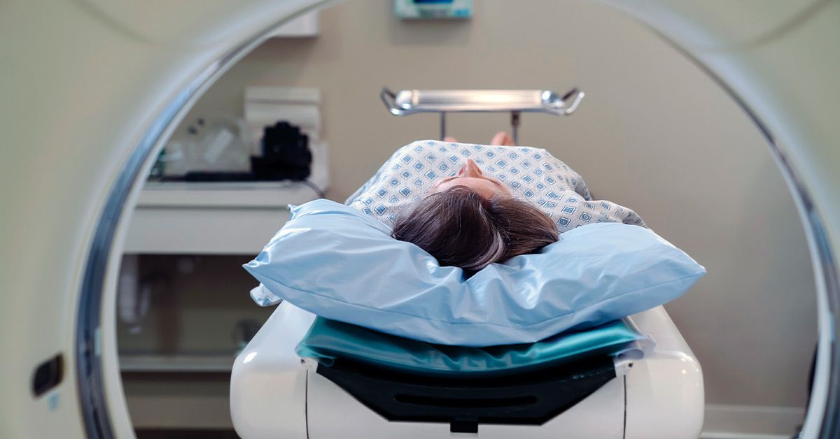 Do I Need an MRI for My Migraine?