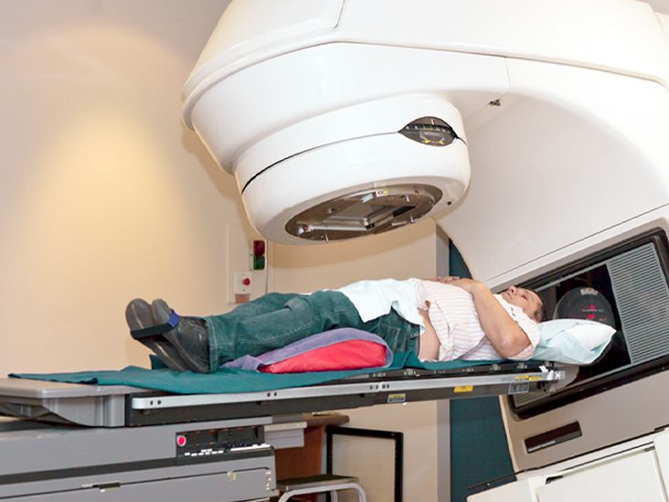 Radiation for Prostate Cancer: When It's Used, Side Effects & More