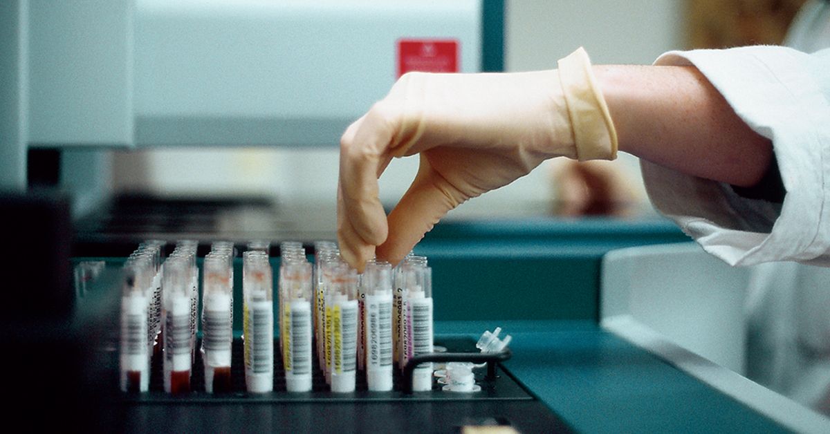 Is a Negative HIV Test at 6 Weeks Conclusive? Answers and More
