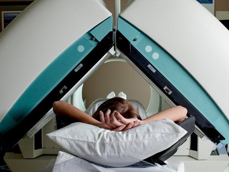 Do I Need an MRI for My Migraine?