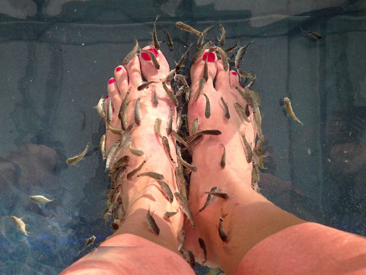 https://media.post.rvohealth.io/wp-content/uploads/2021/04/Fish-Pedicures-732x549-thumbnail.jpg