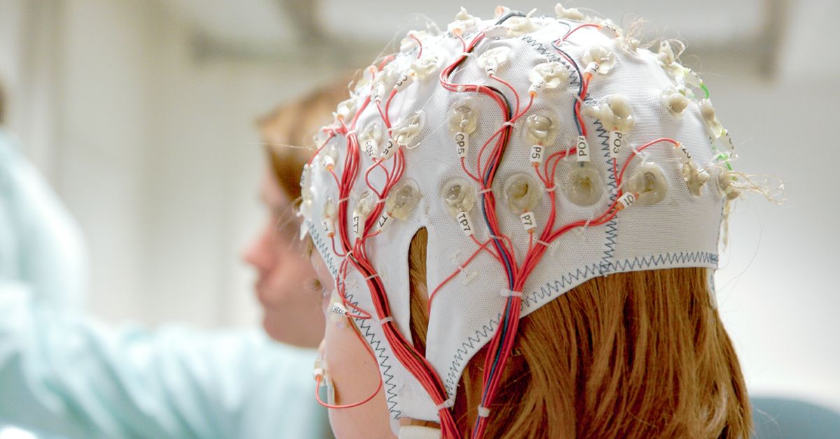 Epilepsy Diagnosis Blood Tests, Imaging, Neuropsychology