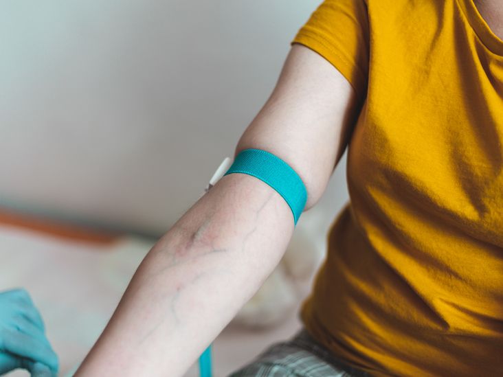 How the colour of a wristband can improve patient management ?