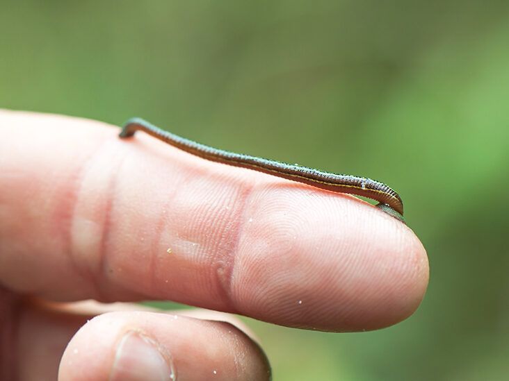 How to Remove a Leech: Steps, Treatment & More