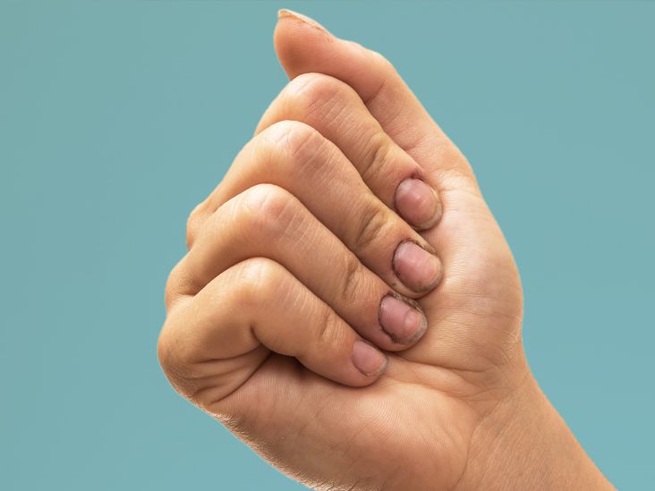 Shaking hands is disgusting – here's what else you can do