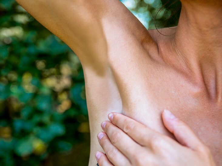 Swollen Lymph Nodes in the Armpit: Pictures, Treatments, & More