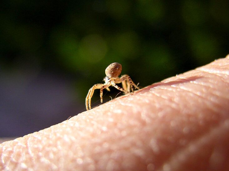 spider bites pictures on humans