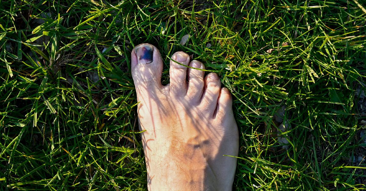 How Long Does It Take A Toenail To Grow Out How Long Does It Take for a Toenail to Grow Back?
