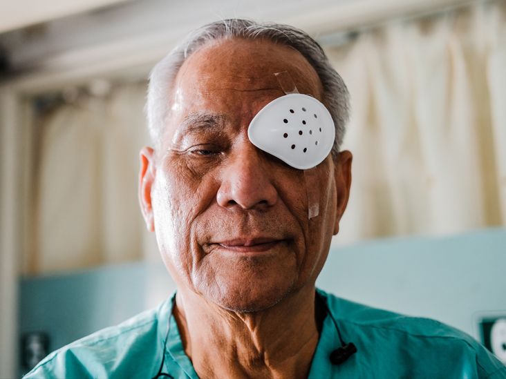 cataract-surgery-recovery-what-you-need-to-know