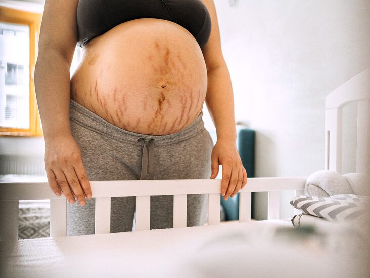 Rash on breast - pregnant, help!