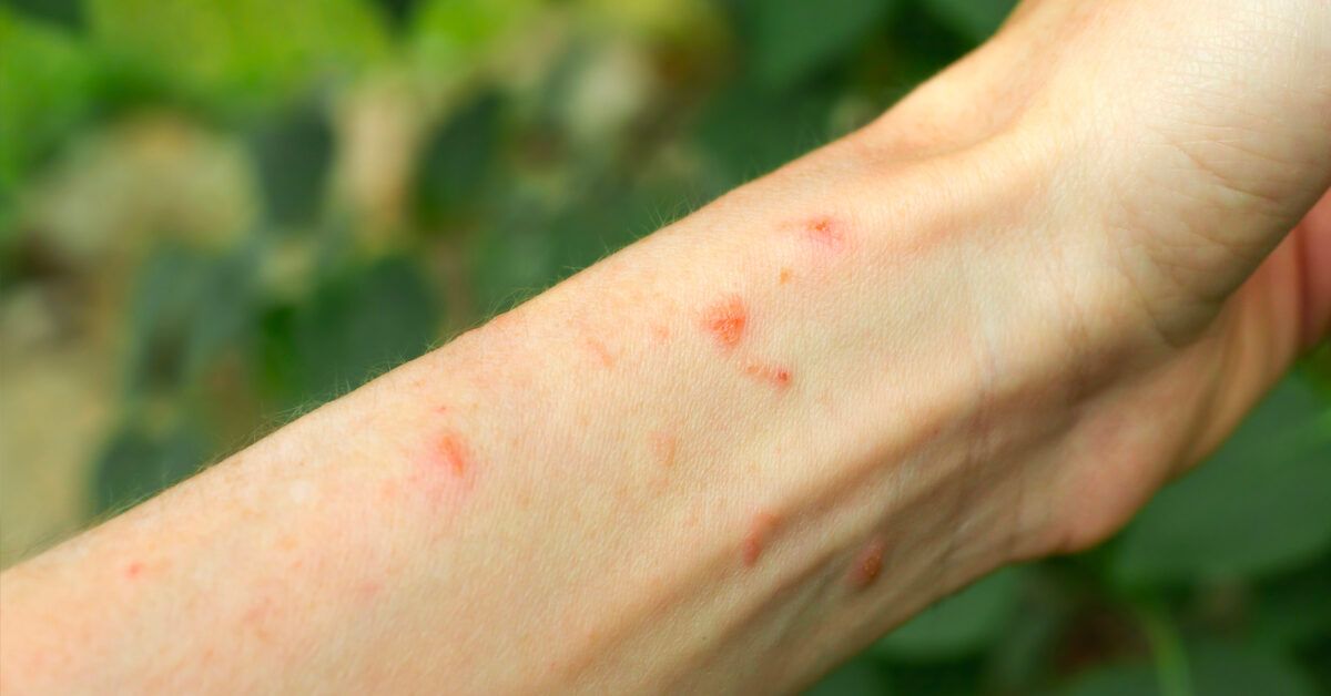 Know the signs: from itchy skin to vertigo - common and more