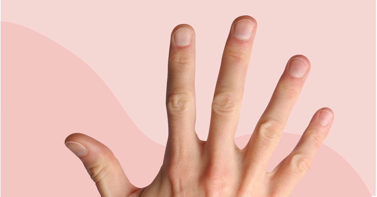 White Spots on Your Nails Think Zinc Deficiency  HealthPost NZ