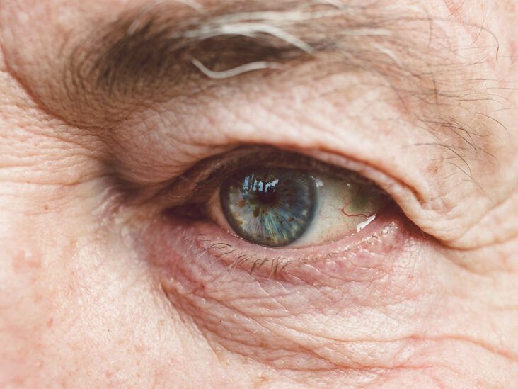 Your Eyes as You Age: What to Know