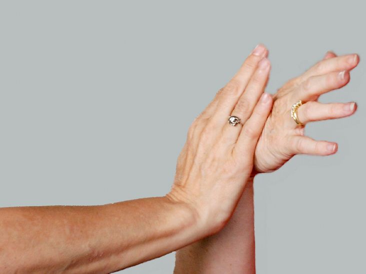 Wrist Exercises for Arthritis Pain Relief