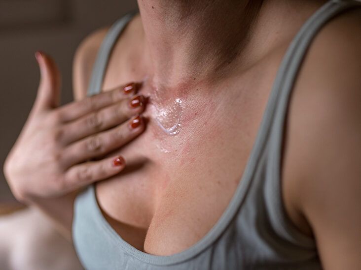 Skin allergy from seasonal changing between breast that's not