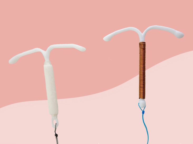 What it's like to get an IUD coil fitted and how does it work?