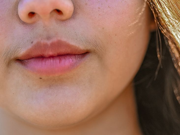 Women With PCOS Explain Why They Celebrate Their Facial Hair | Allure