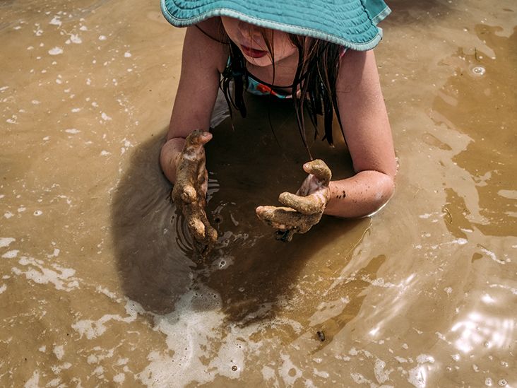 Leptospirosis: Causes, Symptoms, Diagnosis, and Treatment