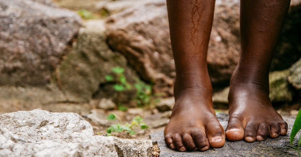 Plantar Fasciitis and Multiple Sclerosis: Understanding Foot Pain