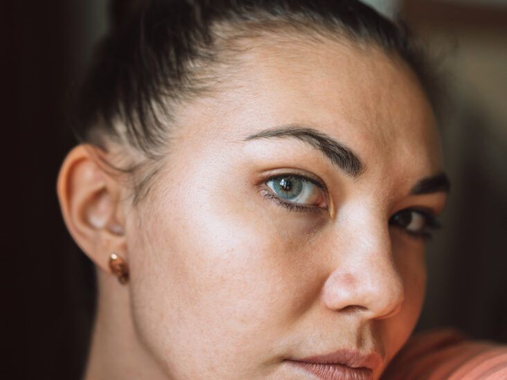 What to Know Before Seeing a Dry Eye Specialist