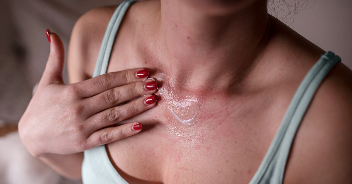 Can my hand rash be an STD? - Dr Ben Medical - Men's Health Clinic |  Women's Health Singapore