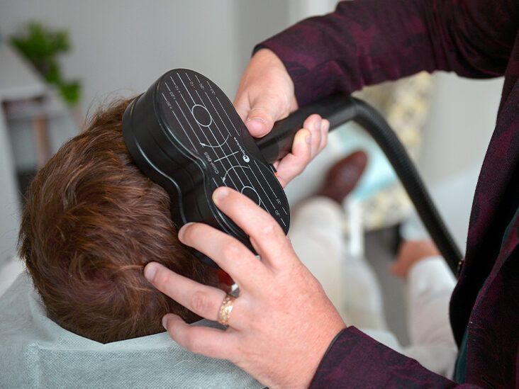 How Does Transcranial Magnetic Stimulation (TMS) Treat Migraine?